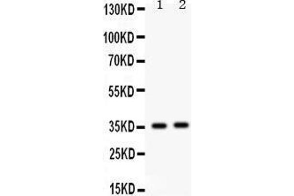 FOSB 抗体  (C-Term)