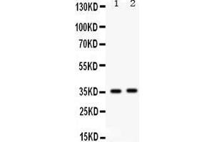 Western Blotting (WB) image for anti-FBJ Murine Osteosarcoma Viral Oncogene Homolog B (FOSB) (AA 264-291), (C-Term) antibody (ABIN3042399)