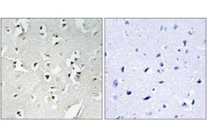 Immunohistochemistry (IHC) image for anti-PMS1 Postmeiotic Segregation Increased 1 (S. Cerevisiae) (PMS1) (AA 441-490) antibody (ABIN2890023) (PMS1 抗体  (AA 441-490))