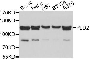 Western blot analysis of extracts of various cell lines, using PLD2 antibody. (Phospholipase D2 抗体)