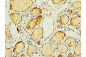 Immunohistochemistry (IHC) image for anti-Sodium Channel, Voltage-Gated, Type III, alpha Subunit (SCN3A) (AA 274-400) antibody (ABIN7169924)