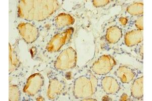 Immunohistochemistry of paraffin-embedded human thyroid tissue using ABIN7169924 at dilution of 1:100 (SCN3A 抗体  (AA 274-400))