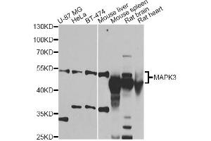 Western blot analysis of extracts of various cell lines, using MAPK8 antibody (ABIN1873631) at 1:1000 dilution. (JNK 抗体)