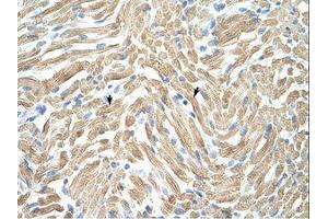 Image no. 1 for anti-Tropomyosin alpha-1 Chain (TM7) (AA 20-69) antibody (ABIN203350) (TM7 抗体  (AA 20-69))