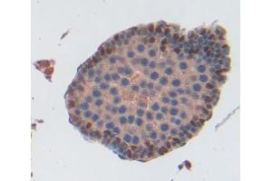 Immunohistochemistry (IHC) image for anti-ATP-Binding Cassette, Sub-Family A (ABC1), Member 9 (ABCA9) (AA 1416-1583) antibody (ABIN5013177)