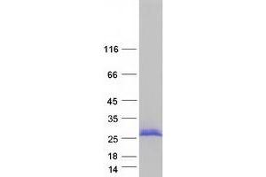 Validation with Western Blot (NCALD Protein (Transcript Variant 7) (Myc-DYKDDDDK Tag))