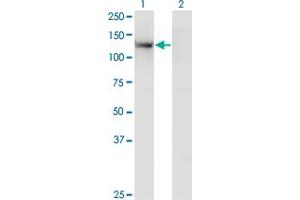 Western Blot analysis of TSHZ1 expression in transfected 293T cell line by SDCCAG33 monoclonal antibody (M07), clone 2F1. (TSHZ1 抗体  (AA 619-717))
