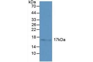 Detection of HSPb3 in Human Liver Tissue using Polyclonal Antibody to Heat Shock Protein Beta 3 (HSPb3) (HSPB3 抗体  (AA 1-150))