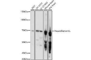Western blot analysis of extracts of various cell lines, using Neurofilament L antibody (ABIN3020808, ABIN3020809, ABIN3020810 and ABIN6213733) at 1:1000 dilution. (NEFL 抗体  (AA 400-543))