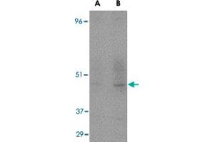 Western blot detection of CD209 fusion protein in human placenta at (A) 1 and (B) 2 ug/mL . (DC-SIGN/CD209 抗体)