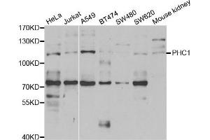 Western blot analysis of extracts of various cell lines, using PHC1 antibody. (PHC1 抗体)