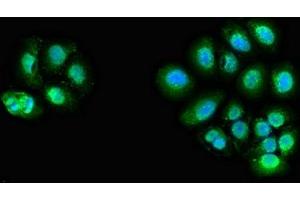 Immunofluorescent analysis of A549 cells using ABIN7144062 at dilution of 1:100 and Alexa Fluor 488-congugated AffiniPure Goat Anti-Rabbit IgG(H+L) (ZFAND6 抗体  (AA 1-208))