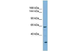 WB Suggested Anti-KL Antibody Titration:  0. (Klotho 抗体  (N-Term))