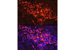 Immunofluorescence analysis of human colon carcinoma cells using Myeloperoxidase (MPO) Rabbit pAb (ABIN6128315, ABIN6143964, ABIN6143965 and ABIN6217844) at dilution of 1:50 (40x lens). (Myeloperoxidase 抗体  (AA 50-310))