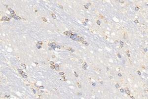 Immunohistochemistry (Paraffin-embedded Sections) (IHC (p)) image for anti-NAD Dependent Malate Dehydrogenase (NAD-ME) antibody (ABIN7074757)