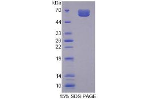 SDS-PAGE analysis of Human MYBPC3 Protein. (MYBPC3 蛋白)