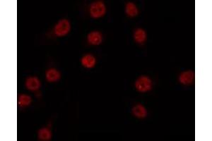 ABIN6266816 staining COS7 by IF/ICC. (XRN2 抗体)