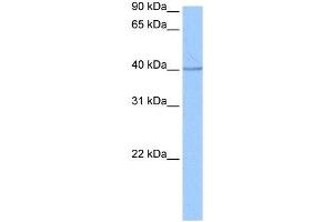 SP6 antibody used at 0. (SP6 抗体  (C-Term))