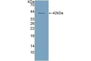 Detection of Recombinant CLEC4L, Human using Polyclonal Antibody to Cluster Of Differentiation 209 (CD209) (DC-SIGN/CD209 抗体  (AA 70-404))