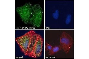 Immunofluorescence (IF) image for anti-Transient Receptor Potential Cation Channel, Subfamily M, Member 7 (TRPM7) (C-Term) antibody (ABIN184611)