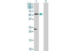 Western Blot analysis of AZIN1 expression in transfected 293T cell line by AZIN1 MaxPab polyclonal antibody. (Antizyme Inhibitor 1 抗体  (AA 1-448))