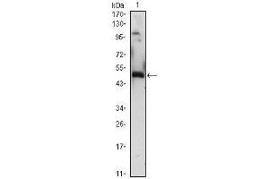 Western Blot showing EGR1 antibody used against EGR1 (AA: 282-433)-hIgGFc transfected HEK293 (1)cell lysate.
