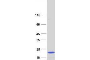Western Blotting (WB) image for Interleukin 1 delta (FIL1d) (Transcript Variant 2) protein (Myc-DYKDDDDK Tag) (ABIN2723372)