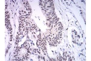Immunohistochemistry (IHC) image for anti-Set1/Ash2 Histone Methyltransferase Complex Subunit ASH2 (ASH2L) (AA 493-628) antibody (ABIN5542582)