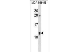Western blot analysis in MDA-MB453 cell line lysates (35ug/lane). (ACBD7 抗体  (C-Term))