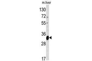 Image no. 1 for anti-ELOVL Fatty Acid Elongase 6 (ELOVL6) (N-Term) antibody (ABIN452952) (ELOVL6 抗体  (N-Term))