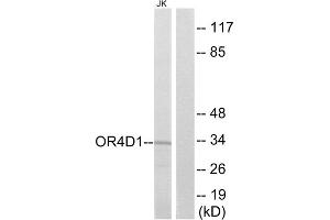 Western blot analysis of extracts from Jurkat cells, using OR4D1 antibody.