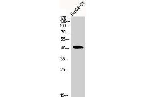 Western Blot analysis of HEPG2-UV cells using Actin α1 Polyclonal Antibody (Actin 抗体  (N-Term))
