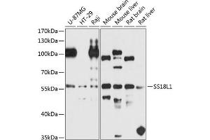 Western blot analysis of extracts of various cell lines, using SS18L1 antibody (ABIN6132117, ABIN6148475, ABIN6148476 and ABIN6224807) at 1:1000 dilution. (SS18L1 抗体  (AA 90-270))