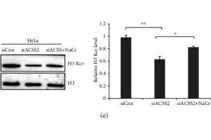 Western Blotting (WB) image for anti-Histone 3 (H3) (C-Term) antibody (ABIN3023243)