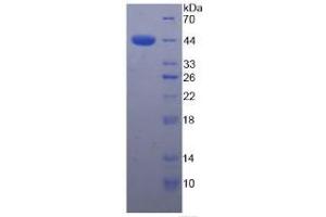 SDS-PAGE (SDS) image for Complement Factor H (CFH) ELISA Kit (ABIN6574180)