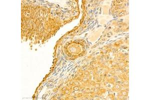 Immunohistochemistry (Paraffin-embedded Sections) (IHC (p)) image for anti-Protein Tyrosine Phosphatase G1 (PTPN12) antibody (ABIN7075292)