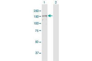 Western Blotting (WB) image for anti-Membrane Associated Guanylate Kinase, WW and PDZ Domain Containing 1 (MAGI1) (AA 1-1256) antibody (ABIN1328587)