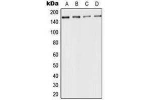 Western blot analysis of CD143 expression in HeLa (A), mouse kidney (B), rat liver (C), PC12 (D) whole cell lysates.