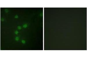 Immunofluorescence analysis of HuvEc cells, using Telomerase (Ab-227) Antibody. (TERT 抗体  (AA 196-245))