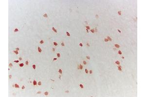 Immunohistochemistry (IHC) image for anti-Proteasome (Prosome, Macropain) Subunit, beta Type, 9 (Large Multifunctional Peptidase 2) (PSMB9) (AA 101-219) antibody (ABIN680698)
