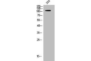 Western Blotting (WB) image for anti-B-Raf proto-oncogene, serine/threonine kinase (BRAF) (pSer446) antibody (ABIN7182576)