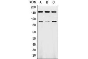 Western blot analysis of TRK B expression in HL60 (A), SKNSH (B), mouse brain (C) whole cell lysates. (TRKB 抗体  (Center))