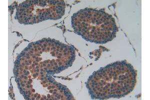Used in DAB staining on fromalin fixed paraffin- embedded kidney tissue (Lactate Dehydrogenase A 抗体  (AA 1-332))
