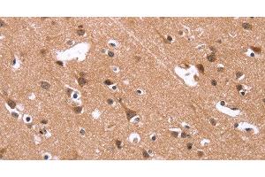 Immunohistochemistry of paraffin-embedded Human brain using HSD17B1 Polyclonal Antibody at dilution of 1:40 (HSD17B1 抗体)