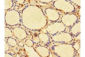 Immunohistochemistry of paraffin-embedded human thyroid tissue using ABIN7157917 at dilution of 1:100 (DBR1 抗体  (AA 1-220))