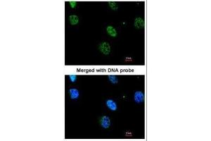 ICC/IF Image Immunofluorescence analysis of paraformaldehyde-fixed HeLa, using MAPKAP Kinase 3 , antibody at 1:200 dilution. (MAPKAP Kinase 3 抗体)