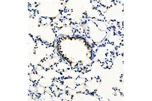 Immunohistochemistry of paraffin embedded rat lung using GP1BA (ABIN7074109) at dilution of 1:600 (300x lens) (CD42b 抗体)
