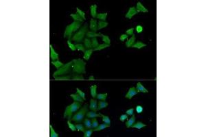 Immunofluorescence analysis of MCF7 cells using HABP2 Polyclonal Antibody (HABP2 抗体)