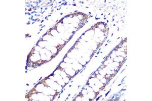 Immunohistochemistry of paraffin-embedded human colon using  Rabbit mAb (ABIN1678801, ABIN3018058, ABIN3018059 and ABIN7101573) at dilution of 1:100 (40x lens). (Angiopoietin 1 抗体)