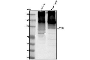 Western blot analysis of ATP1A3 using anti-ATP1A3 antibody (ABIN7600851).